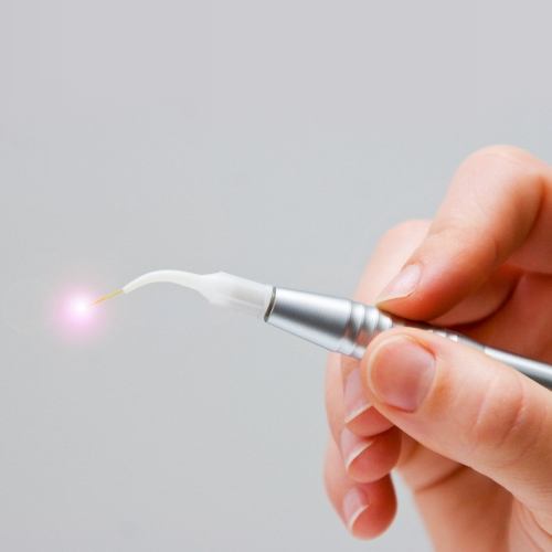 Hand holding a soft tissue laser dentistry tool