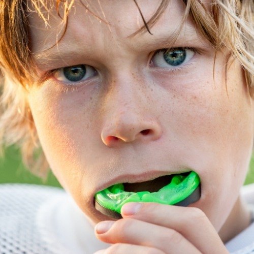 Teen placing athletic mouthguard