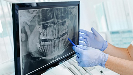 Dentist reviewing X-ray with patient