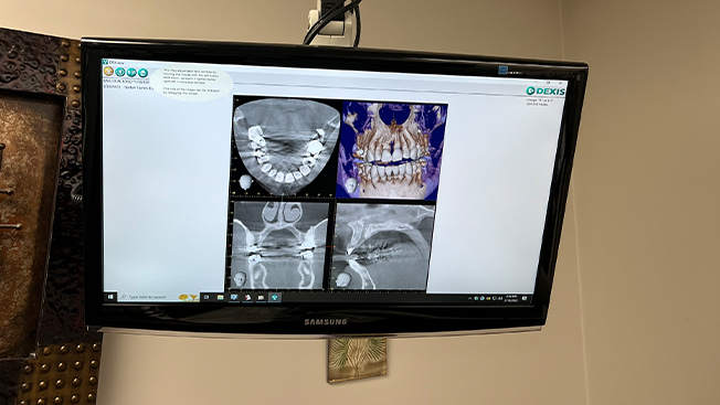 Digital smile images on chairside computer monitor