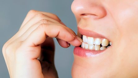 Closeup of person biting their nails