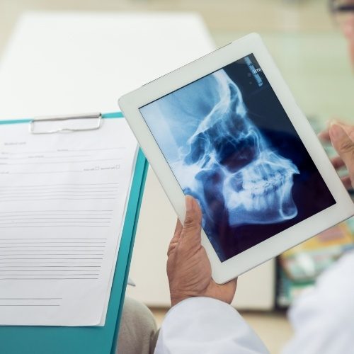 X ray of jaw an skull bone used for diagnosis and T M J treatment planning